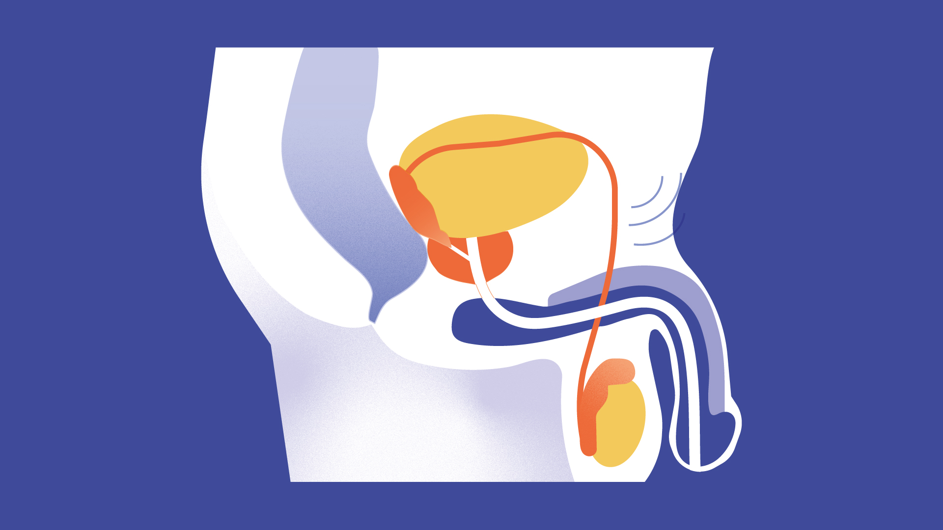 Updated patient education content with for men with prostate cancer